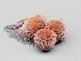 BAZEL: Otkriven protein koji može da uspori razvoj raka jetre
