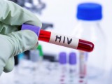 MEDICINA: Druga osoba u svijetu izliječena od HIV-a