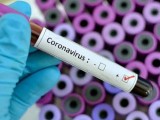 SJEVERNA MAKEDONIJA: Još 193 slučaja pozitivna na korona virus, devet preminulih
