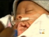 ZANIMLJIVOSTI: Rođenje ove bebe proglašeno čudom medicine