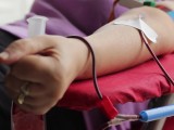 KCCG: Hitno potrebna krv za osamnaestogodišnju djevojku