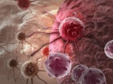 OBEĆAVAJUĆE: Naučnici otkrili kako da zaustave širenje raka