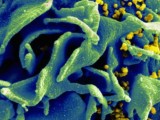 REVOLUCIONARNO: Naučnici uspjeli da uklone HIV iz ljudskih ćelija