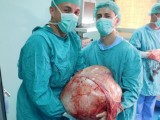 BIH: Banjalučki ljekari uklonili tumor od 31 kilograma