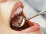 IZMJENE ZAKONA O ZDRAVSTVENOM OSIGURANJU: Ugovori sa zubarima na dvije godine