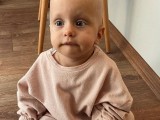 BUDI HUMAN: Uplaćeno 15.000 eura za liječenje jednogodišnje djevojčice Petre